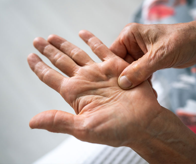 neuropathy
