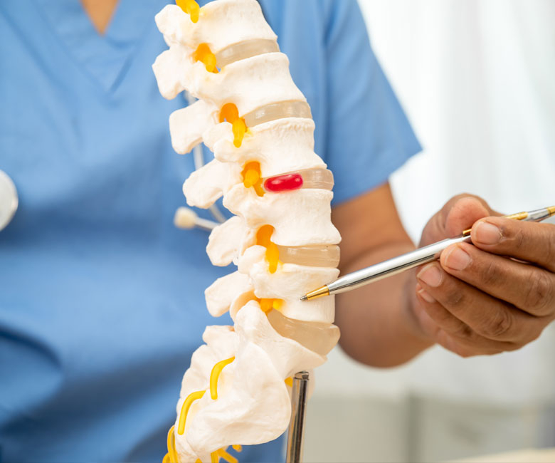 spinal-related